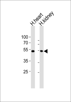 ST3GAL2 Antibody (N-term)
