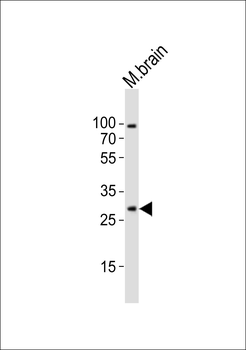 Mouse Olig1 Antibody (Center)