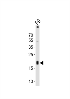 (Mouse) Tdgf1 Antibody (N-term)