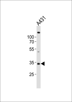 UTF1 Antibody (Center)