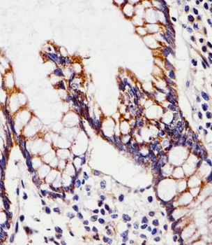 CHST12 Antibody (N-term)