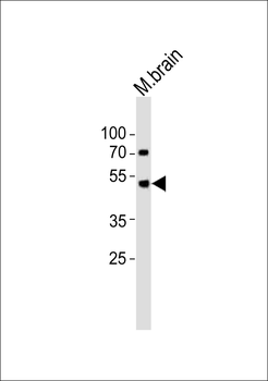 PIP4K2A Antibody (C-term)