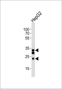SULT1A1 Antibody (C-term)