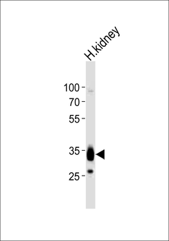 PPAP2A Antibody (C-term)