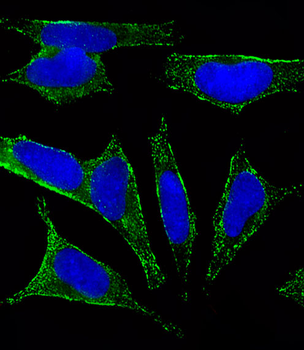 CHRM2 Antibody