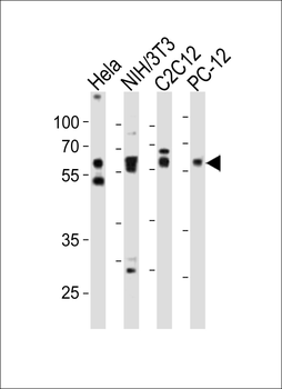 (Mouse) Smad2 Antibody (Center)