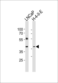 RING1 Antibody (C-term)