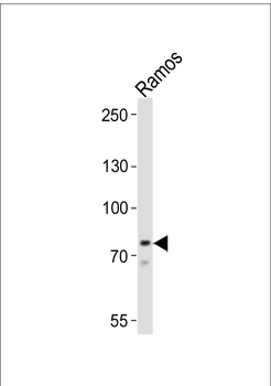 BTK Antibody (Center)