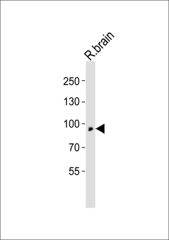 TYRO3 Antibody (C-term)