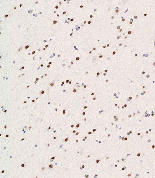 WDR82 Antibody (N-term)