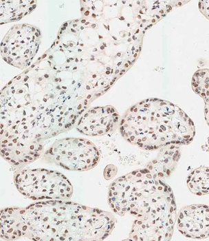 WDR82 Antibody (N-term)