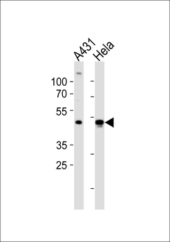 NOVA1 Antibody (Center)