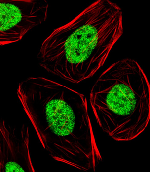 SOX2 Antibody (N-term)