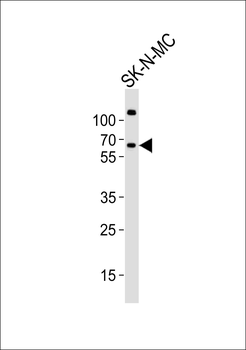 PPP2R5B Antibody (C-term)