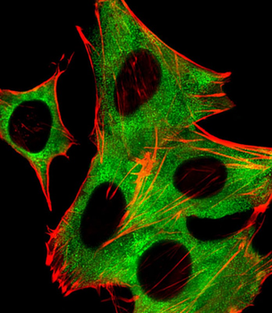 PPP2R5B Antibody (C-term)