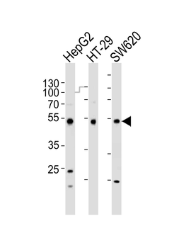 FOXA2 Antibody (C-term)