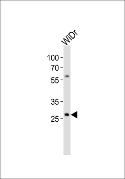 COX11 Antibody (C-term)
