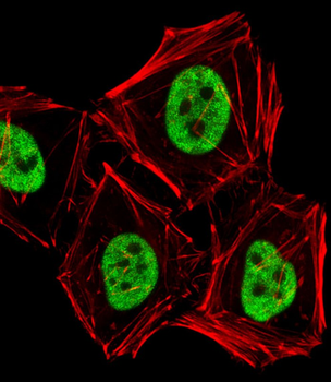 PCGF6 Antibody (C-term)