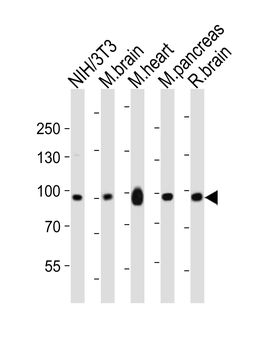 Mouse Ephb1 Antibody (Center)