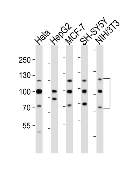 FGFR1 Antibody (Center)