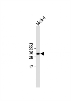 TRBC1 Antibody (Center)