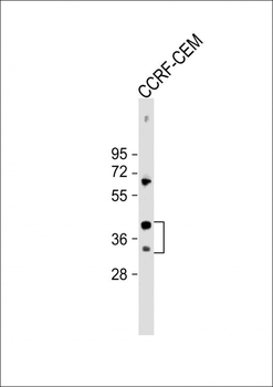 Mouse Nkx2-5 Antibody (Center)