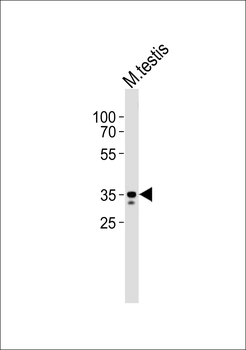 Mouse Ring1 Antibody (C-term)