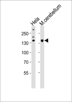 Mouse Kdm6b Antibody (Center)