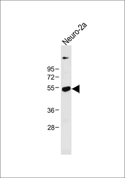 CLN3 Antibody (Center)
