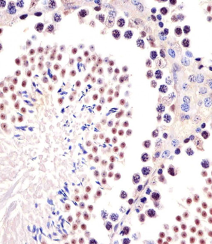 (Mouse) Trim24 Antibody (C-term)