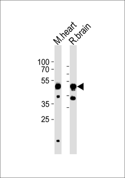 CHRNB3 Antibody (Center)