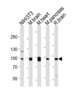 Mouse Ephb1 Antibody (Center)