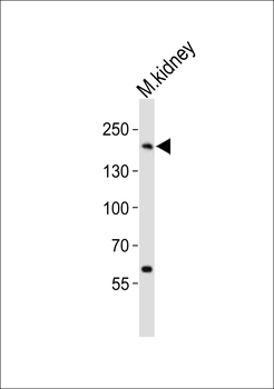 Mouse Erbb2 Antibody (P1142)