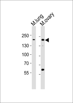 Mouse Erbb2 Antibody (P1142)