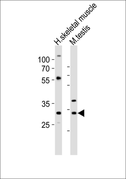 (Mouse) Mlf1 Antibody (Center)