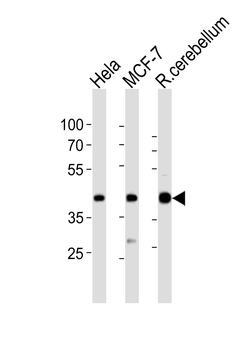 LAPTM4B Antibody