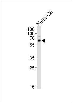 PRKAA1/2 Antibody (N-term)