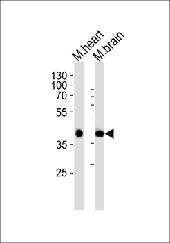 Mouse Sbk1 Antibody (N-term)