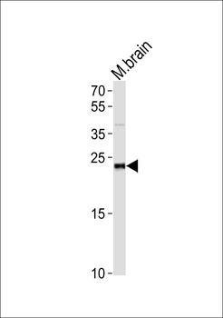 PrLZ Antibody (Center)