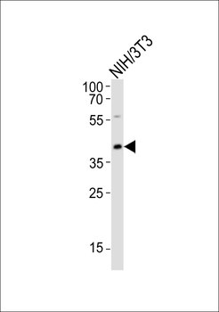 CBX8 Antibody (C-term)