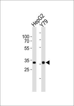 OTX2 Antibody (C-term)