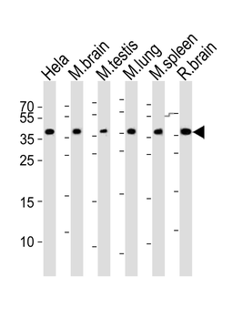 Mouse Cbx7 Antibody (C-term)
