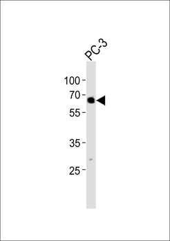 TBX22 Antibody (C-term)