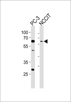 TBX22 Antibody (C-term)