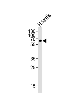 ZIM2 Antibody (N-term)