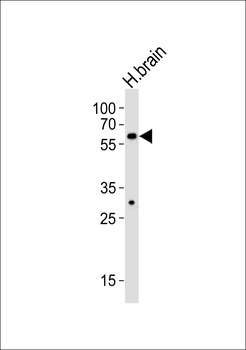 ZNF610 Antibody (C-term)