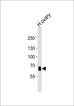 PRDM13 Antibody (N-term)