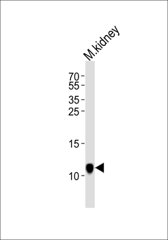 MINOS1 Antibody (N-term)
