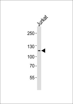 ZNF624 Antibody (Center)