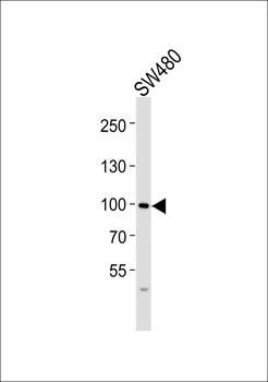 FGFR4 Antibody (N-term)